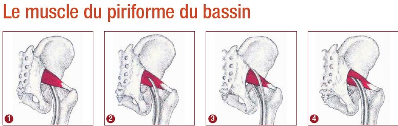 Quand le pyramidal s'en mêle ou comment se défaire d'une fausse ...